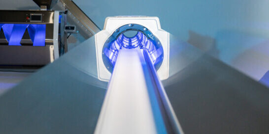 Mobius Conveyors